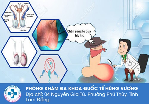 Nam giới nên hết sức cẩn thận trước các loại bệnh lý ở tinh hoàn