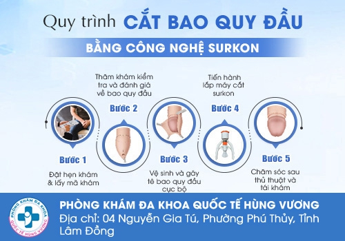 Các bước trong quy trình cắt bao quy đầu