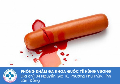 Đứt dây hãm bao quy đầu có sao không?