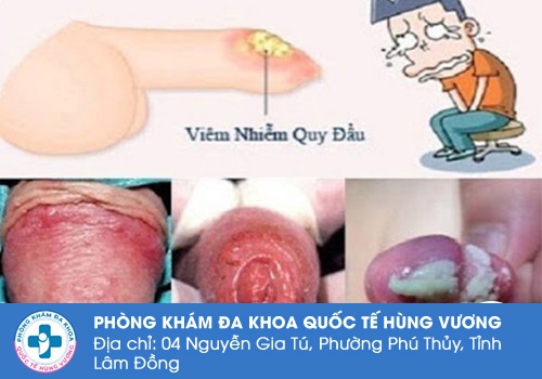 Viêm nhiễm là một trong những mối nguy thường gặp khi dây hãm bị đứt