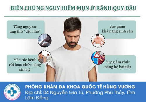 Chuỗi hạt ngọc dương vật có nguy hiểm không?