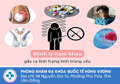Những dấu hiệu nhận biết cho thấy tinh trùng đang có nguy cơ bị yếu