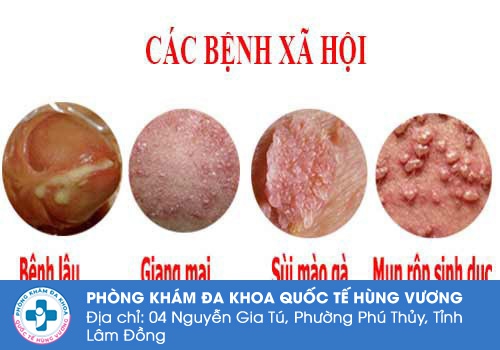 Các bệnh lý xã hội