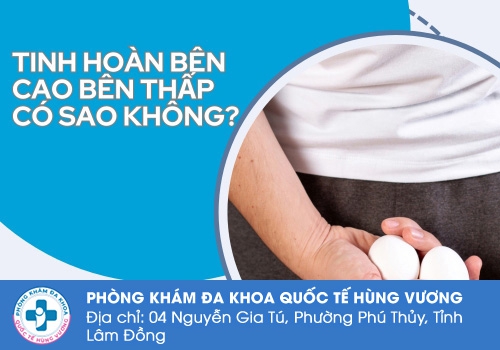 Nguyên nhân tinh hoàn bên cao bên thấp.