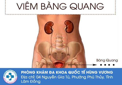Viêm bàng quang là bệnh gì?