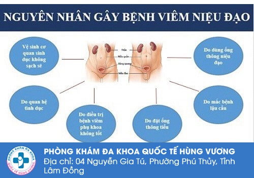 Nguyên nhân gây bệnh viêm niệu đạo ở nam và nữ