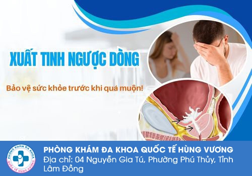 Những nguyên nhân gây xuất tinh ngược dòng.
